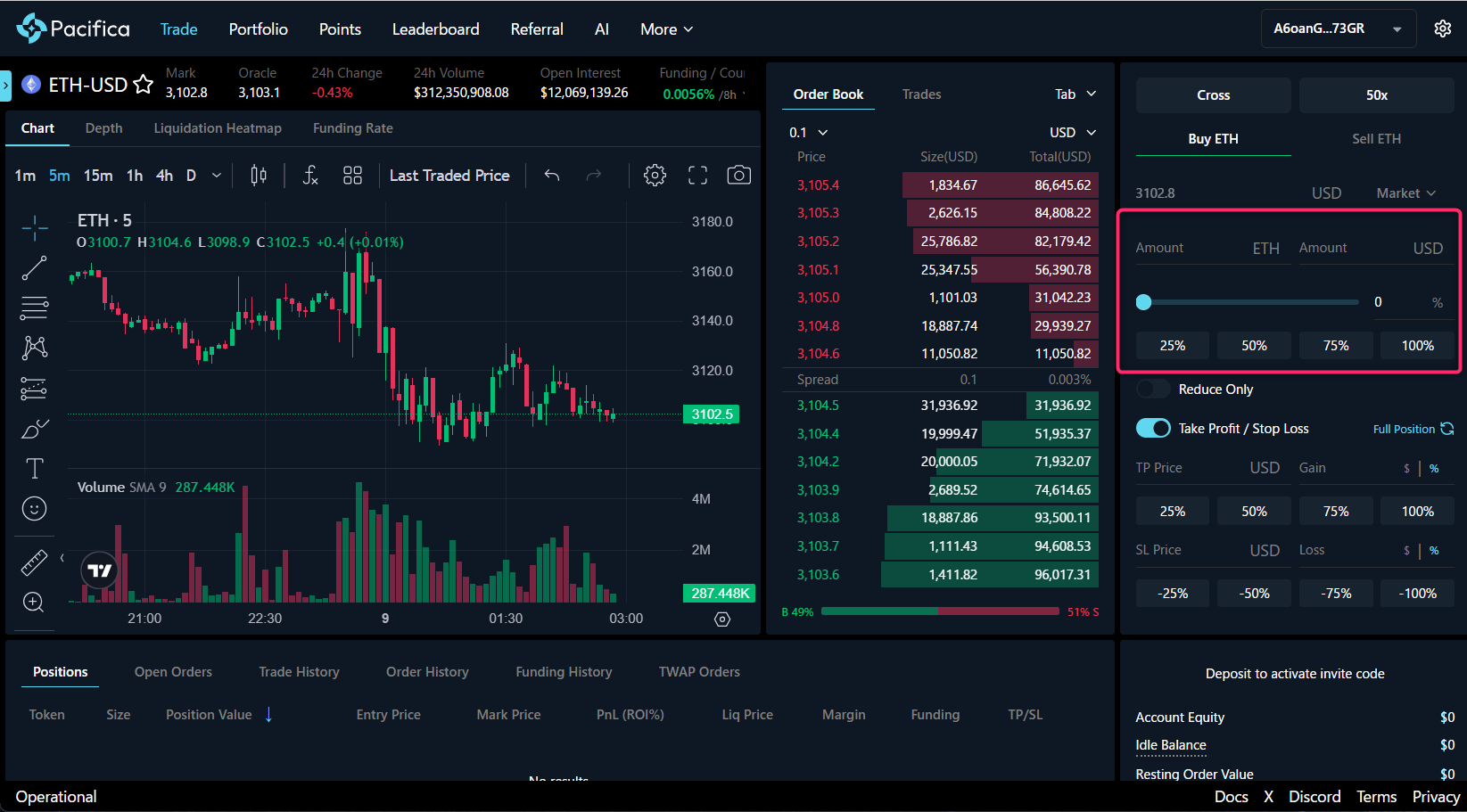 数量・レバレッジを設定する